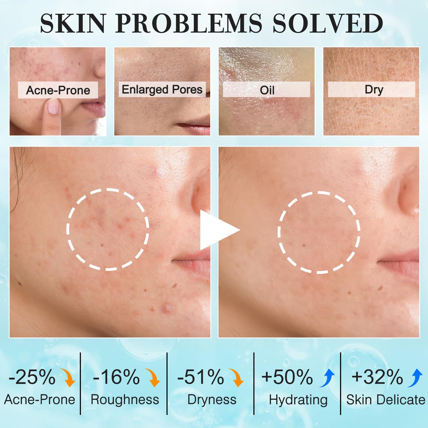 Teen Women Gifts,Skin Care,Skincare,Hydrate,Oil Control,Pore Shrinking,Anti-Allergy Facial Skin Care Routine Kit Travel Size Gift Set Stocking Stuffers for Teen Girls 10-12 16-18 & Women for All Skin